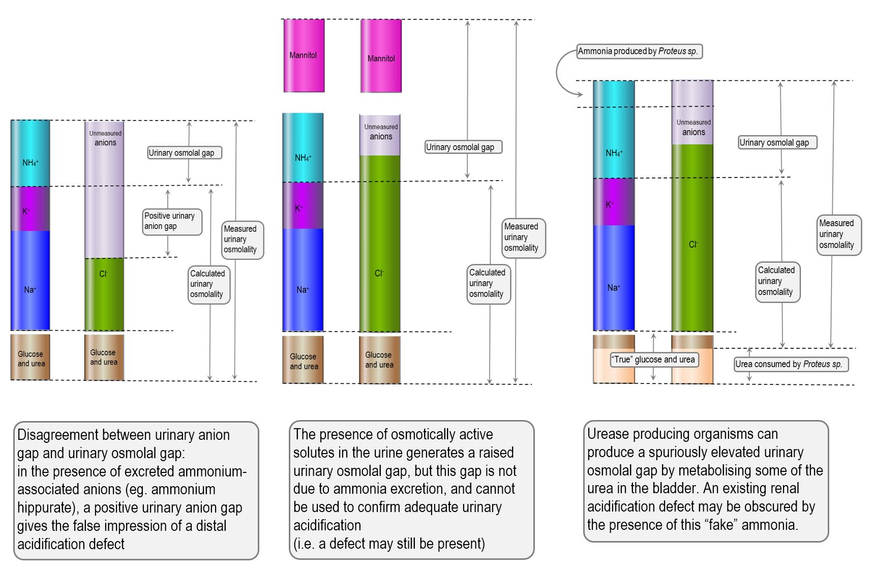 The diagnostic utility of urinary electrolytes Deranged Physiology